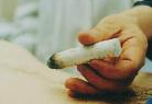 Moxibustion